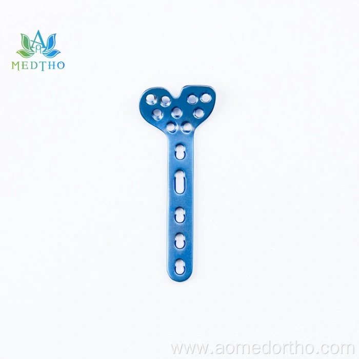 variable angle distal radius plate